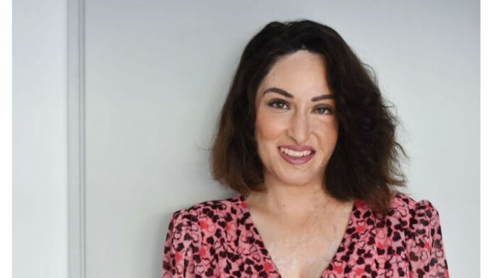 «Νιώθω ότι δεν είμαστε ασφαλείς»: Η Ιωάννα Παλιοσπύρου για την επίθεση που δέχτηκε 49χρονη με καυστικό υγρό