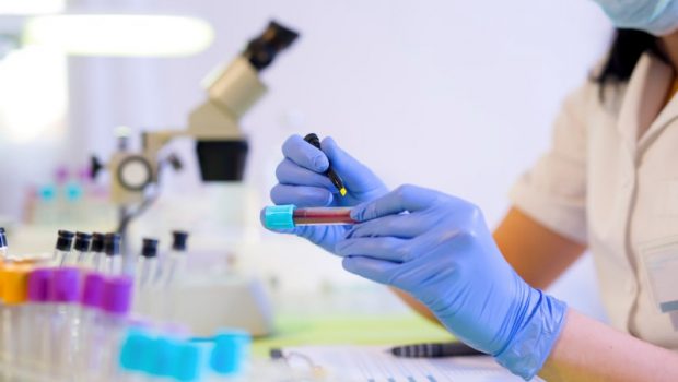 Τεστ αίματος ανιχνεύει τον καρκίνο πριν εμφανιστούν κύρια συμπτώματα