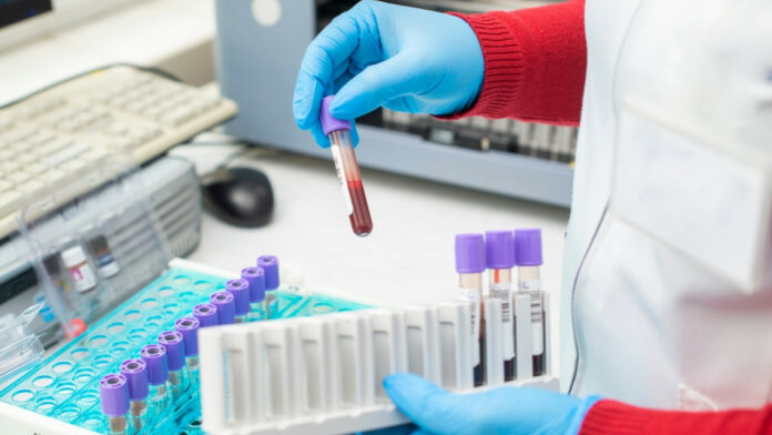 Γρίπη: Συναγερμός στον ΕΟΔΥ- Ασυνήθιστα αυξημένη η διασπορά