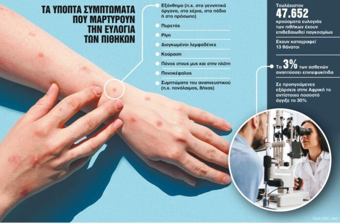 Η ευλογία των πιθήκων επηρεάζει αρνητικά τα μάτια και την όραση