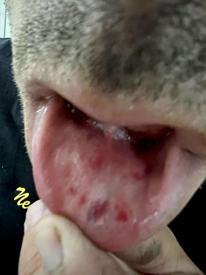 Κρήτη: Άγρια επίθεση σε αστυνομικό από τέσσερις άνδρες