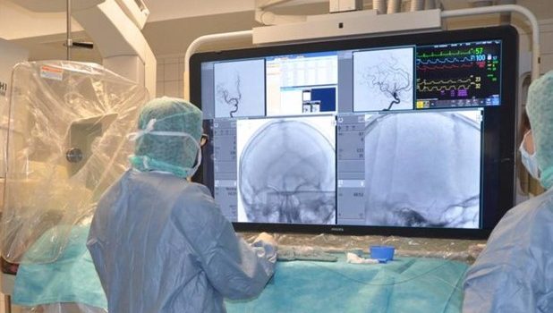 Μελέτη: Ποια ομάδα αίματος έχει μεγαλύτερο κίνδυνο για πρώιμο εγκεφαλικό