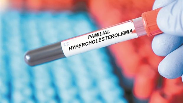 Οταν ο οργανισμός δεν απομακρύνει την «κακή» χοληστερόλη