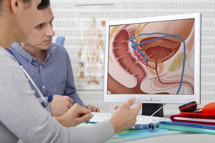 Prostate_Cancer-1024x682.jpg