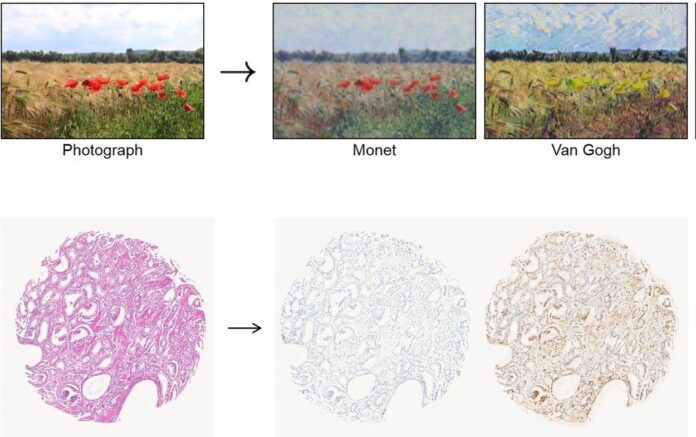 Καρκίνος: Δημιούργησαν μοντέλο ΑΙ για τη διάγνωσή του – Επικεφαλής ελληνίδα ερευνήτρια