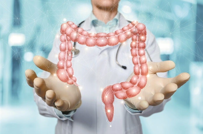 Καρκίνος παχέος εντέρου: «Το θετικό τεστ δεν ισοδυναμεί με διάγνωση κακοήθειας»