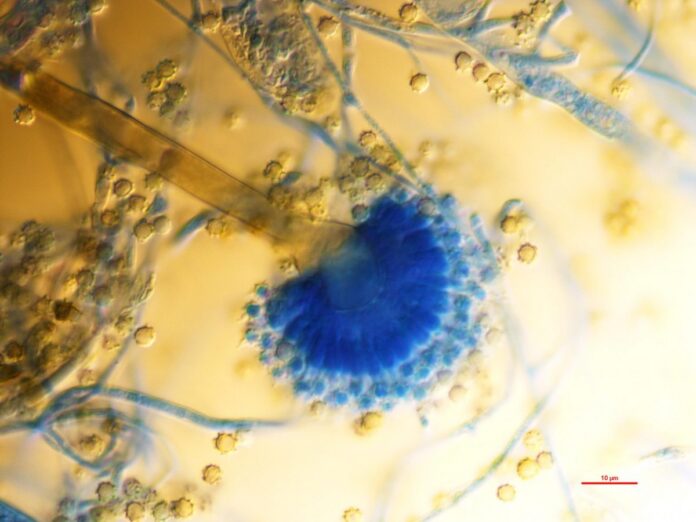 Ασπέργιλλος: Ο μύκητας που τρομάζει την δημόσια υγεία της Ευρώπης