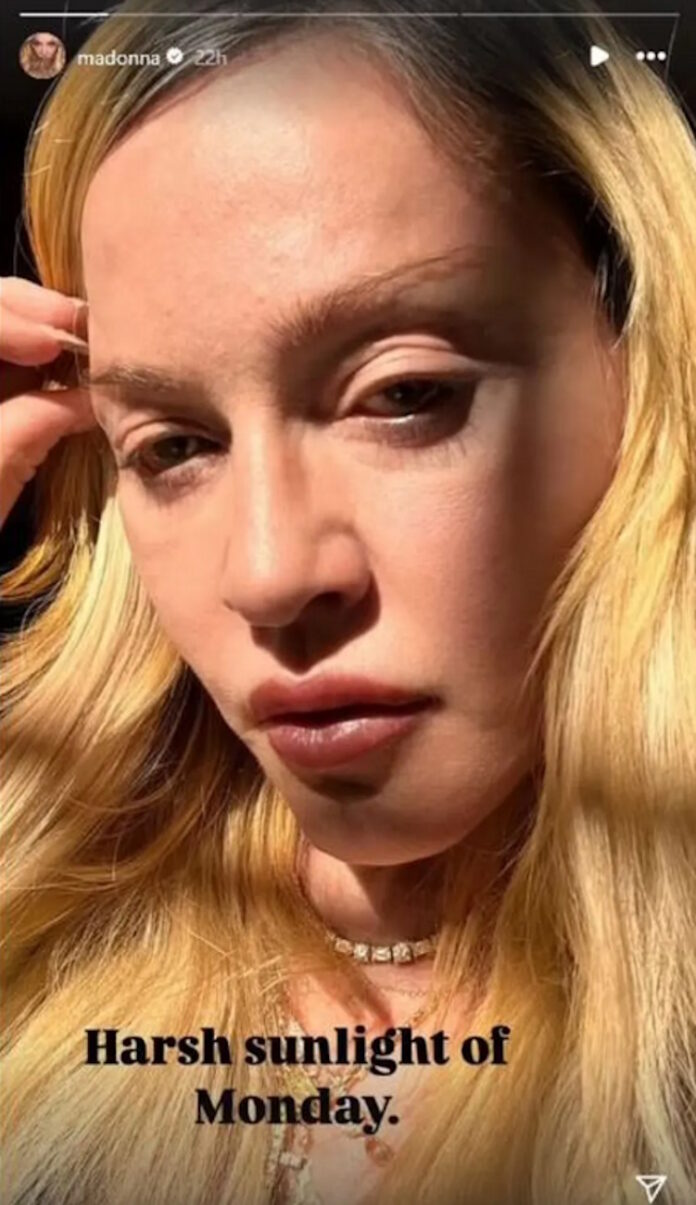 Αγνώριστη σε φωτογραφία που ανέβασε στο Instagram δίχως τα φίλτρα ομορφιάς