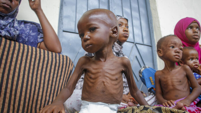 ap-somalia-peina.jpg